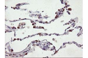 Image no. 1 for anti-Src-like-adaptor 2 (SLA2) antibody (ABIN1500949) (SLAP2 抗体)