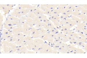 Immunohistochemistry (IHC) image for anti-Transient Receptor Potential Cation Channel, Subfamily A, Member 1 (TRPA1) (AA 63-370) antibody (ABIN7441301)