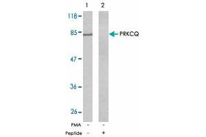 Western blot analysis of exreacts from Jurkat cells untreated or treated with PMA (1 ng/mL, 5 min) using PRKCQ polyclonal antibody . (PKC theta 抗体)