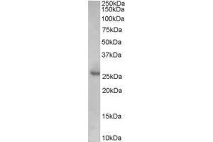 Western Blotting (WB) image for anti-Cyclin-Dependent Kinase Inhibitor 1B (p27, Kip1) (CDKN1B) (Internal Region) antibody (ABIN2465872) (CDKN1B 抗体  (Internal Region))