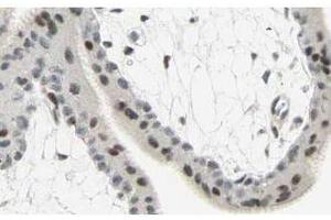 Immunohistochemistry (IHC) image for anti-SMAD, Mothers Against DPP Homolog 3 (SMAD3) (C-Term) antibody (ABIN129676)