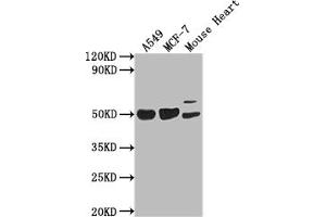Western Blot Positive WB detected in: A549 whole cell lysate, MCF-7 whole cell lysate, Mouse Heart tissue All lanes: SRGAP2B antibody at 1:2000 Secondary Goat polyclonal to rabbit IgG at 1/50000 dilution Predicted band size: 54 kDa Observed band size: 54 kDa (SLIT-ROBO rho GTPase Activating Protein 2B (SRGAP2B) (AA 79-150) 抗体)