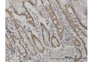 Immunoperoxidase of monoclonal antibody to AKT2 on formalin-fixed paraffin-embedded human small Intestine. (AKT2 抗体  (AA 100-189))