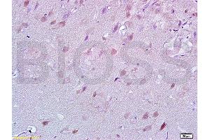 Formalin-fixed and rat brain tissue labeled with Anti-Lingo-1 Polyclonal Antibody, unconjugated  (ABIN738801)  at 1: 200 followed by incubation with conjugated secondary antibody and DAB staining (LINGO1 抗体  (AA 521-620))