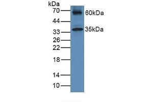 Detection of HJV in Mouse Heart Tissue using Polyclonal Antibody to Hemojuvelin (HJV)