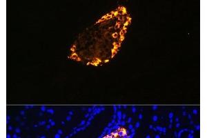 Immunofluorescence analysis of Rat pancreas using SST Polyclonal Antibody at dilution of 1:100 (40x lens). (Somatostatin 抗体)