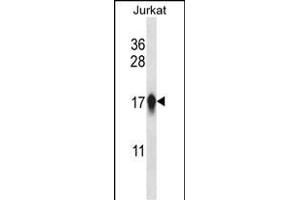 CEN Antibody (Center) (ABIN657764 and ABIN2846742) western blot analysis in Jurkat cell line lysates (35 μg/lane). (CENPA 抗体  (AA 82-110))