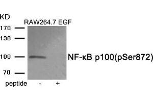 Western blot analysis of extracts from RAW264. (NFKB2 抗体  (pSer872))