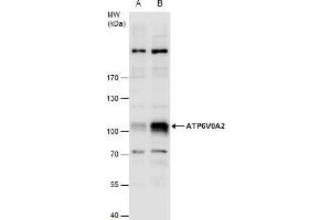 WB Image ATP6V0A2 antibody detects ATP6V0A2 protein by western blot analysis. (ATP6V0A2 抗体  (Internal Region))