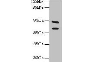 Western blot All lanes: CA12 antibody at 6 μg/mL + Mouse kidney tissue Secondary Goat polyclonal to rabbit IgG at 1/10000 dilution Predicted band size: 40, 39 kDa Observed band size: 40, 48 kDa (CA12 抗体  (AA 25-301))