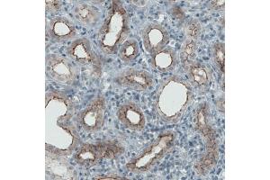 Immunohistochemical staining (Formalin-fixed paraffin-embedded sections) of human kidney with OCLN monoclonal antibody, clone CL1567  shows membranous positivity in renal tubules. (Occludin 抗体  (AA 282-415))