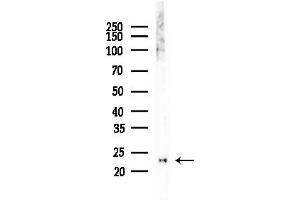 anti-Basic Transcription Factor 3-Like 4 (BTF3L4) (Internal Region) antibody