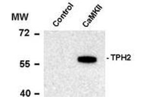 Image no. 1 for anti-Tryptophan Hydroxylase 2 (TPH2) (pSer19) antibody (ABIN372731) (Tryptophan Hydroxylase 2 抗体  (pSer19))