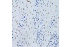 Immunohistochemistry of paraffin-embedded human esophagus using HNRNPK Antibody.