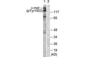 Western blot analysis of extracts from HepG2 cells, using c-Met (Phospho-Tyr1003) Antibody. (c-MET 抗体  (pTyr1003))