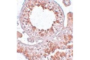 Immunohistochemical staining of human testis tissue with ESX1 polyclonal antibody  at 25 ug/mL dilution.