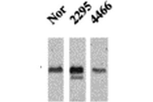 Western Blot analysis of Mouse Ventricle lysates showing detection of CaMKII protein using Mouse Anti-CaMKII Monoclonal Antibody, Clone 22B1 . (CAMKII gamma 抗体  (Biotin))