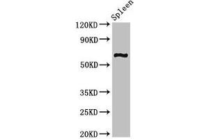 Western Blot Positive WB detected in: Mouse spleen tissue All lanes: CNKSR3 antibody at 2 μg/mL Secondary Goat polyclonal to rabbit IgG at 1/50000 dilution Predicted band size: 62, 101, 93 kDa Observed band size: 62 kDa (CNKSR3 抗体  (AA 301-555))