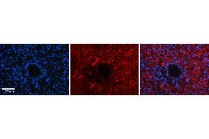 Rabbit Anti-DNAJB12 Antibody   Formalin Fixed Paraffin Embedded Tissue: Human Liver Tissue Observed Staining: Cytoplasm in hepatocytes Primary Antibody Concentration: 1:100 Other Working Concentrations: 1:600 Secondary Antibody: Donkey anti-Rabbit-Cy3 Secondary Antibody Concentration: 1:200 Magnification: 20X Exposure Time: 0. (DNAJB12 抗体  (Middle Region))
