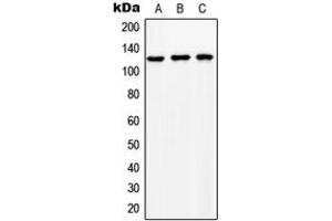 Western blot analysis of NCKX1 expression in HeLa (A), SP2/0 (B), NIH3T3 (C) whole cell lysates. (SLC24A1 抗体  (Center))