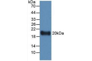 Western blot analysis of recombinant Human IL19. (IL-19 抗体  (AA 25-177))