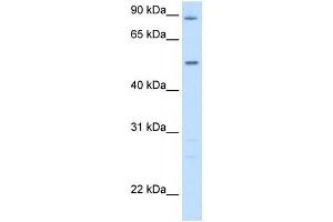 GPT antibody used at 5 ug/ml to detect target protein. (ALT 抗体)
