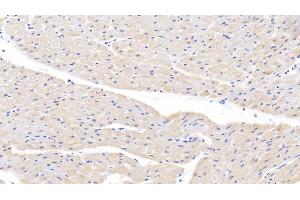 Detection of LOX1 in Bovine Cardiac Muscle Tissue using Polyclonal Antibody to Lectin Like Oxidized Low Density Lipoprotein Receptor 1 (LOX1)