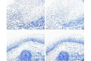Rb (pS780) staining on tonsil. (Retinoblastoma 1 抗体  (pSer780))