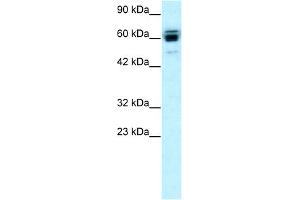 WB Suggested Anti-RNF12 Antibody Titration:  0. (RLIM 抗体  (C-Term))