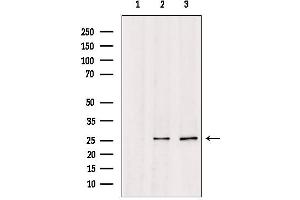 Western blot analysis of extracts from various samples, using TSPAN8 Antibody. (Tspan-8 抗体  (Internal Region))