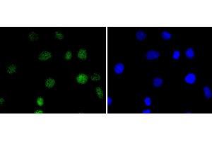 A549 cells were stained with IRF2 (5F2) Monoclonal Antibody  at [1:200] incubated overnight at 4C, followed by secondary antibody incubation, DAPI staining of the nuclei and detection. (IRF2 抗体)