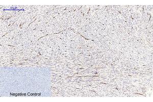 Immunohistochemical analysis of paraffin-embedded human uterus tissue.