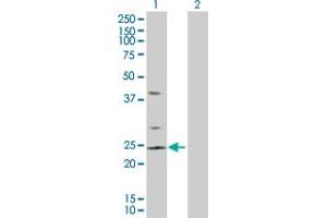 Western Blot analysis of RHOC expression in transfected 293T cell line by RHOC MaxPab polyclonal antibody. (RHOC 抗体  (AA 1-193))