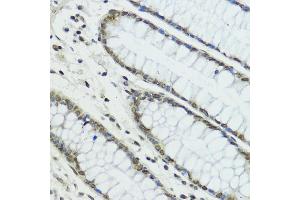 Immunohistochemistry of paraffin-embedded human colon using TRIP12 antibody (ABIN6129753, ABIN6149543, ABIN6149544 and ABIN6225295) at dilution of 1:100 (40x lens). (TRIP12 抗体  (AA 1-240))