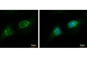 ICC/IF Image RGS7 antibody detects RGS7 protein at endoplasmic reticulum by immunofluorescent analysis. (RGS7 抗体)