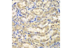 Immunohistochemistry of paraffin-embedded mouse kidney using MBP antibody at dilution of 1:200 (400x lens). (MBP 抗体)