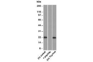 Western blot testing of human Jurkat lysate in the absence and presence of immunizing peptide, and mouse thymus lysate probed with CD3e antibody. (CD3 epsilon 抗体)