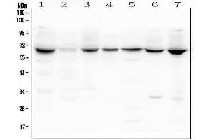 Western blot analysis of LBR using anti-LBR antibody (ABIN6719340). (Lamin B Receptor 抗体  (AA 102-209))