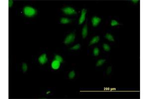 Immunofluorescence of purified MaxPab antibody to STK3 on HeLa cell. (STK3 抗体  (AA 1-491))