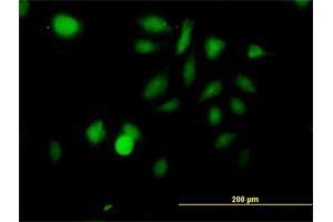 Immunofluorescence of purified MaxPab antibody to STK3 on HeLa cell.