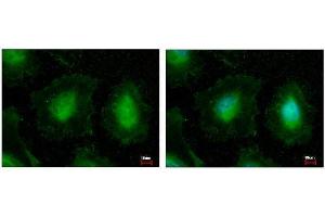 Immunofluorescence (IF) image for anti-Eukaryotic Translation Initiation Factor 3 Subunit K (EIF3K) antibody (ABIN2855253)