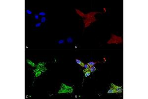 Immunocytochemistry/Immunofluorescence analysis using Mouse Anti-TrpM7 Monoclonal Antibody, Clone S74 (ABIN2483118). (TRPM7 抗体  (AA 1817-1863) (PerCP))