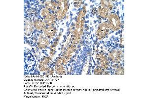 Rabbit Anti-HSD17B1 Antibody  Paraffin Embedded Tissue: Human Kidney Cellular Data: Epithelial cells of renal tubule Antibody Concentration: 4. (HSD17B1 抗体  (N-Term))