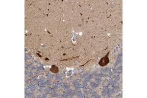 Immunohistochemical staining of human cerebellum with ZNF804B polyclonal antibody  shows strong cytoplasmic positivity in Purkinje cells at 1:200-1:500 dilution. (ZNF804B 抗体)