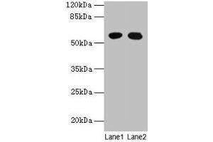 Western blot All lanes: GTPBP6 antibody at 6 μg/mL Lane 1: A549 whole cell lysate Lane 2: Hela whole cell lysate Secondary Goat polyclonal to rabbit IgG at 1/10000 dilution Predicted band size: 57 kDa Observed band size: 57 kDa
