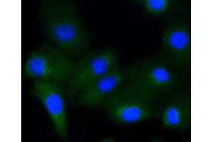 A549 cells were stained with Glycogen synthase 1(S641) (10C1) Monoclonal Antibody  at 1:200 followed by secondary antibody incubation, DAPI staining of the nuclei and detection. (Glycogen Synthase 1 抗体  (pSer641))