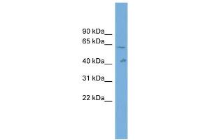 WB Suggested Anti-SLC22A10 Antibody Titration: 0. (SLC22A10 抗体  (Middle Region))