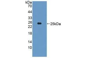 Detection of Recombinant CYP26A1, Human using Polyclonal Antibody to Cytochrome P450 26A1 (CYP26A1) (CYP26A1 抗体  (AA 73-255))