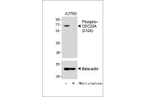 Western blot analysis of lysates from  cell line, untreated or treated with Alkaline phosphatase, 1h, using 459085101 A (upper) or Beta-actin (lower). (CDC25A 抗体  (pSer124))