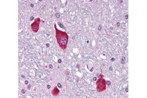 Anti-PTH2R / PTHR2 antibody  ABIN1049269 IHC staining of human brain, neurons and glia. (PTH2R 抗体  (C-Term))